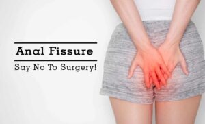 Read more about the article Homeopathy Treatment of Anal Fissure Online-Homeopathy Medicine for Anal Fissure
