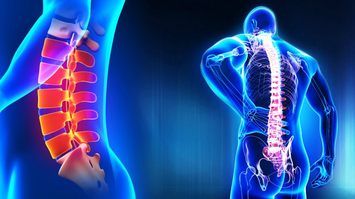 You are currently viewing Homeopathy Treatment of Back Pain Online-Homeopathy Medicine for Back Pain